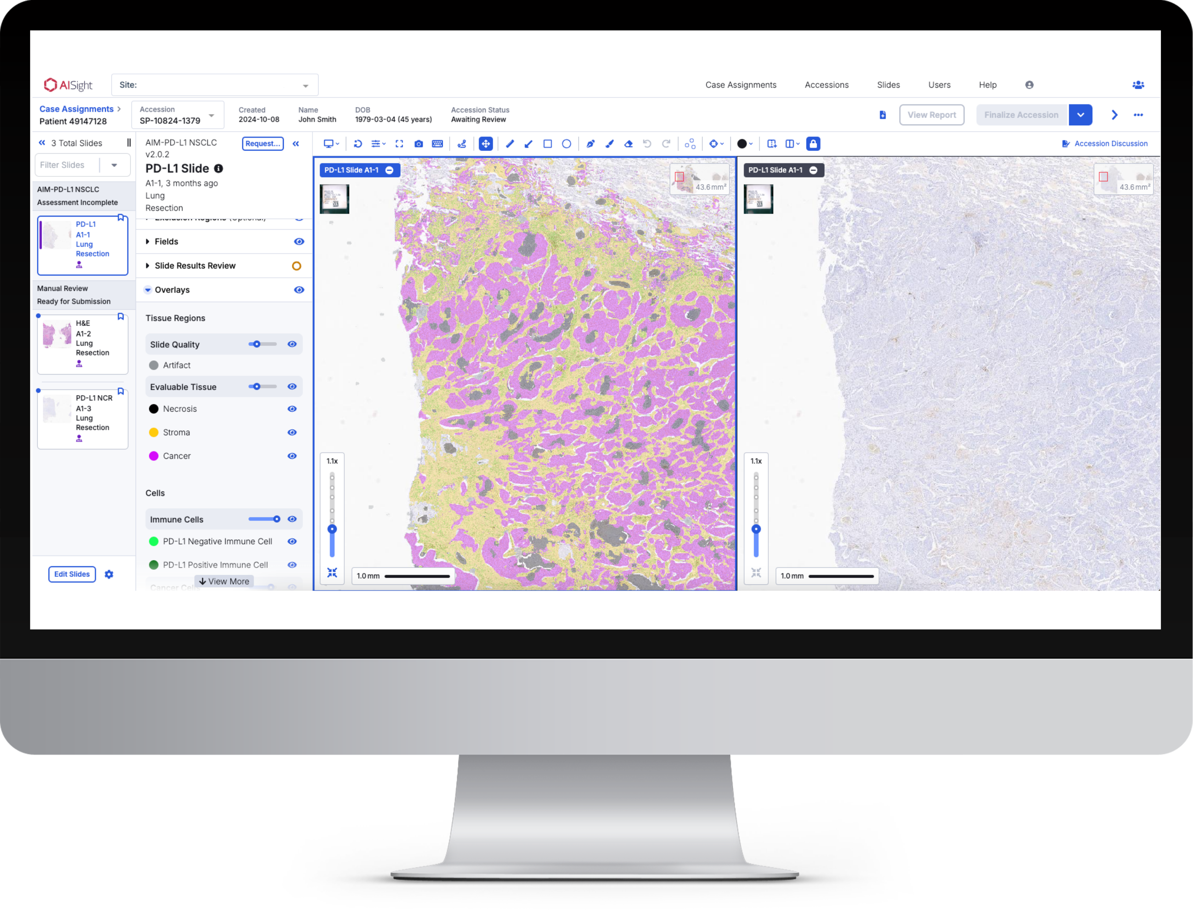Pathai Raqab PathAI Launches Precision Pathology Network