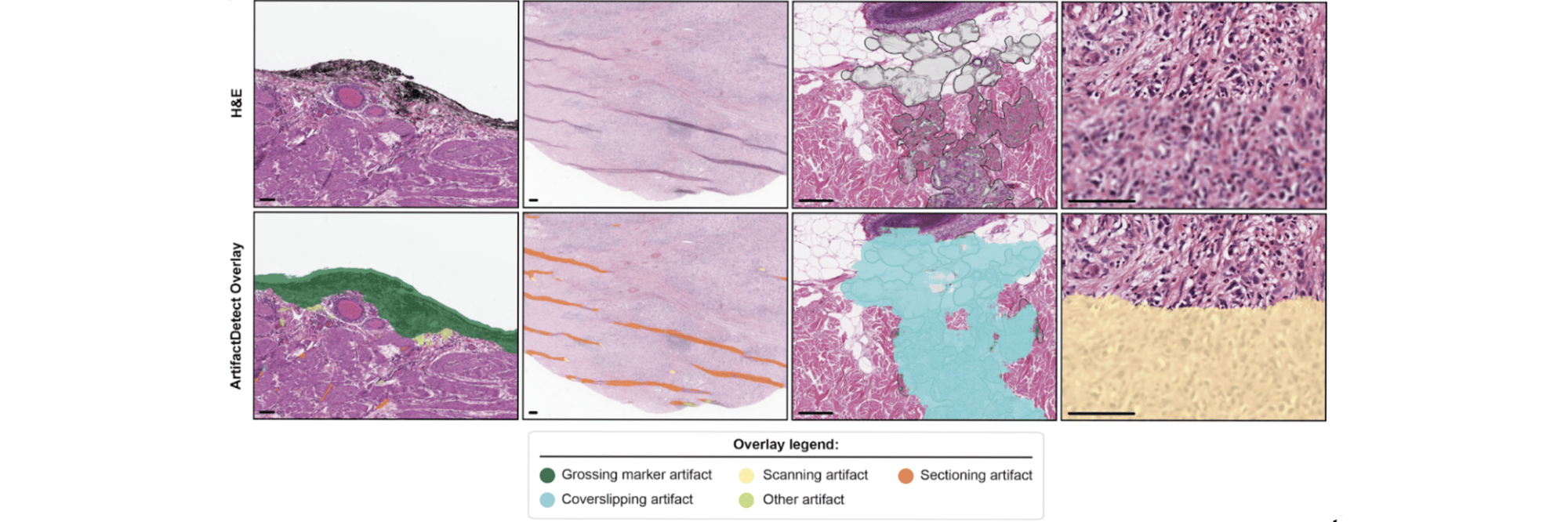ArtifactDetect Data 2-1