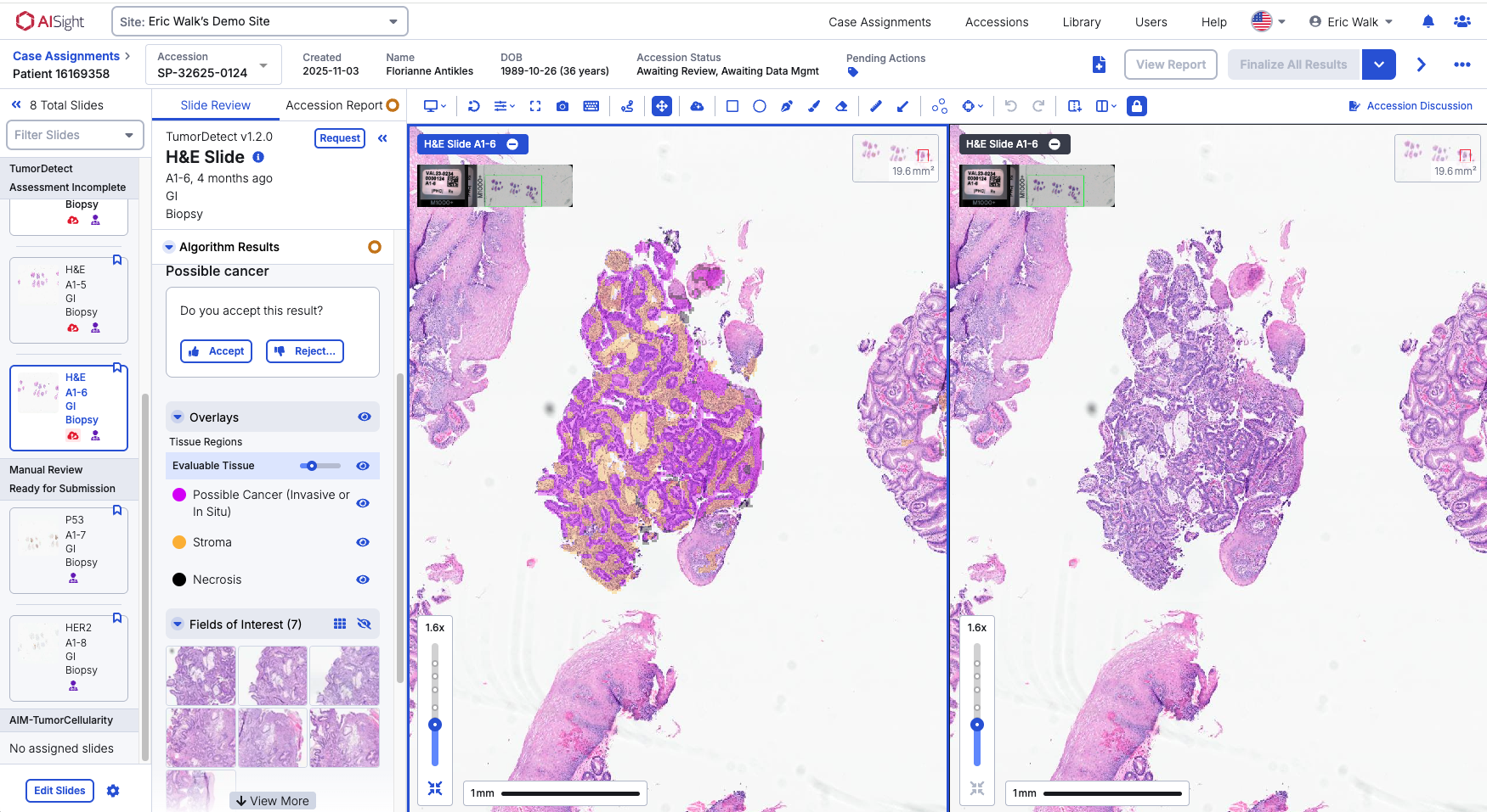 Enhanced Slide Review