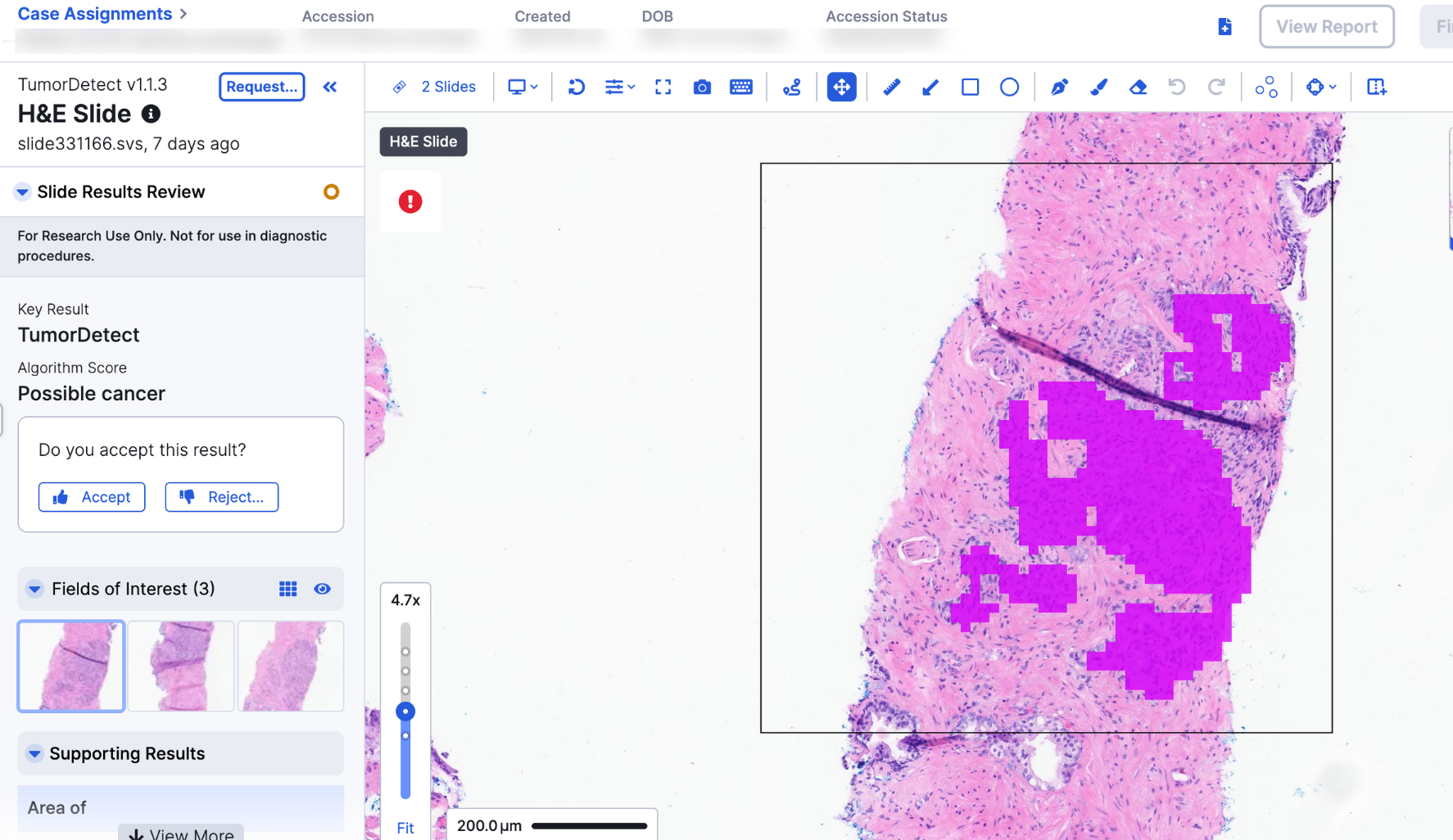 Guided Algorithm Review Experience