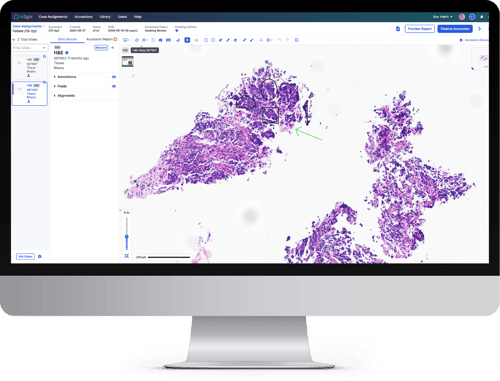 IVD Case Viewer
