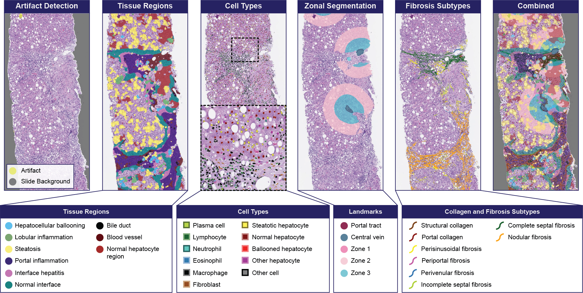 Figure 1. LiverExplore overlays and detected classes