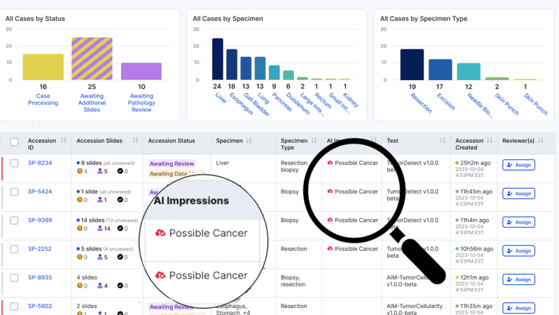 Worklist Prioritization