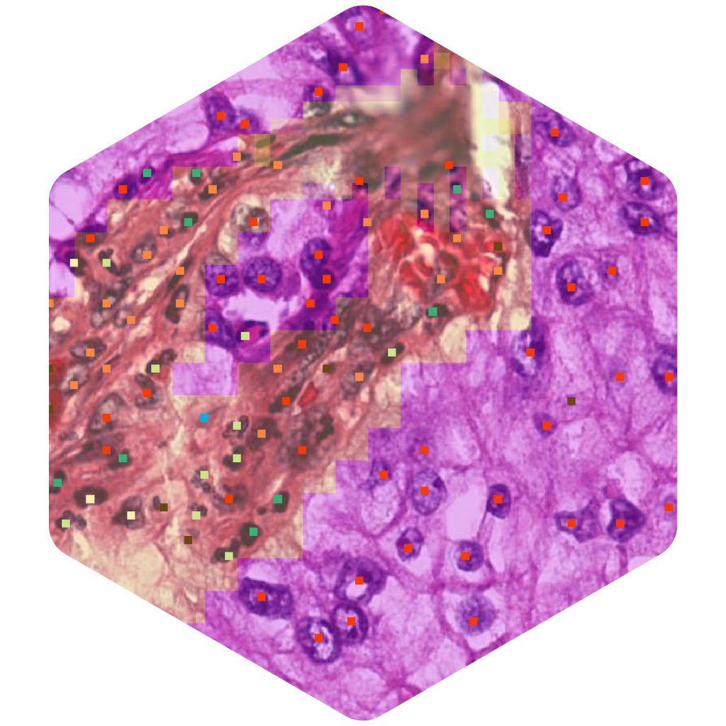 AIM-TumorCellularity