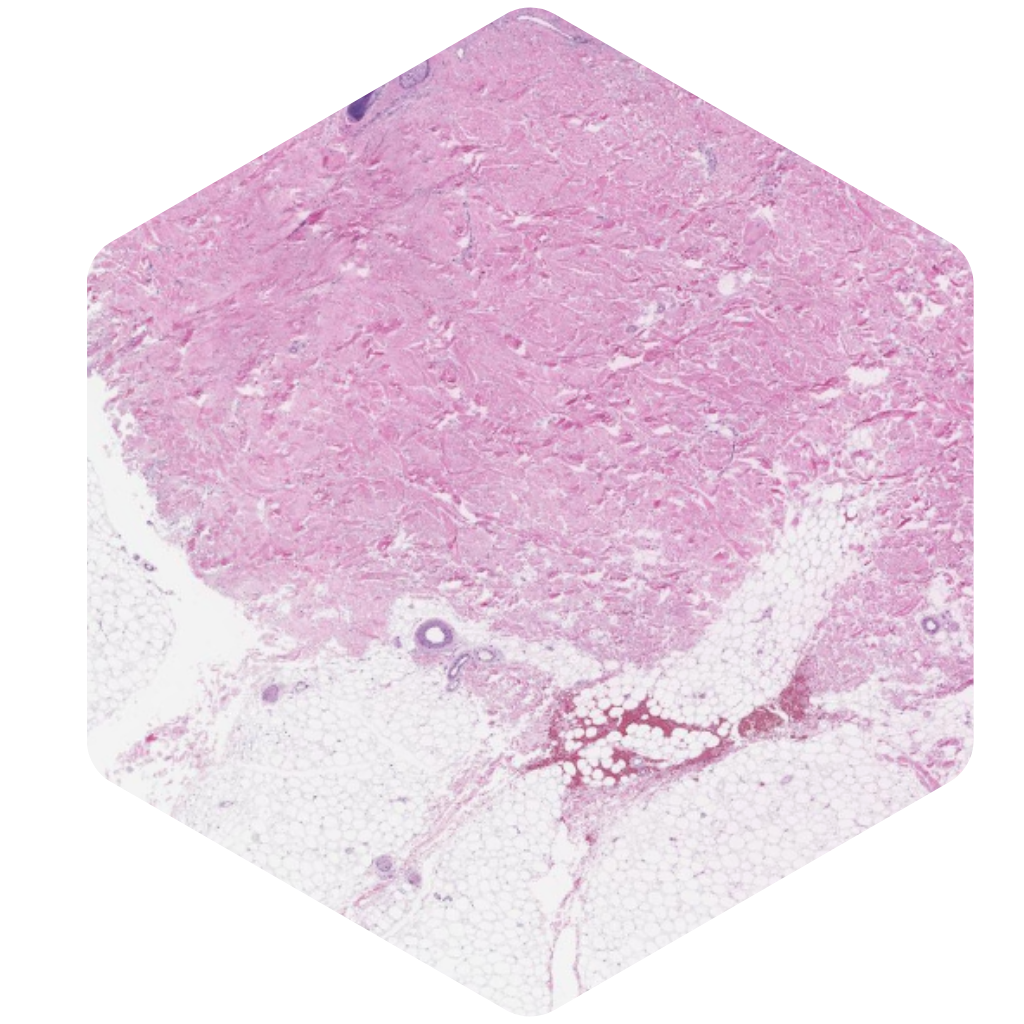 PathAssist Derm hexagon image