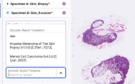 Structured Reporting